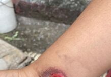 Alumno quema con supuesto nitrógeno líquido a compañeros